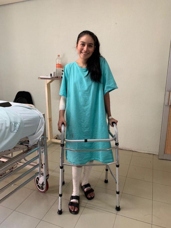 Tras más de 20 cirugías, especialistas del IMSS evitan amputar brazo de joven chiapaneca que sufrió múltiples fracturas