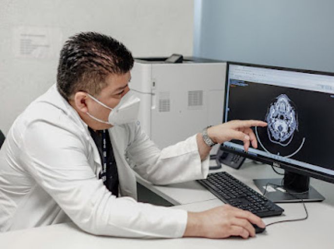 Especialistas del IMSS Chiapas retiran tumor cerebral del tamaño de una manzana a mujer de 67 años